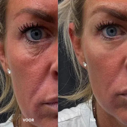 Collageen Oogpads