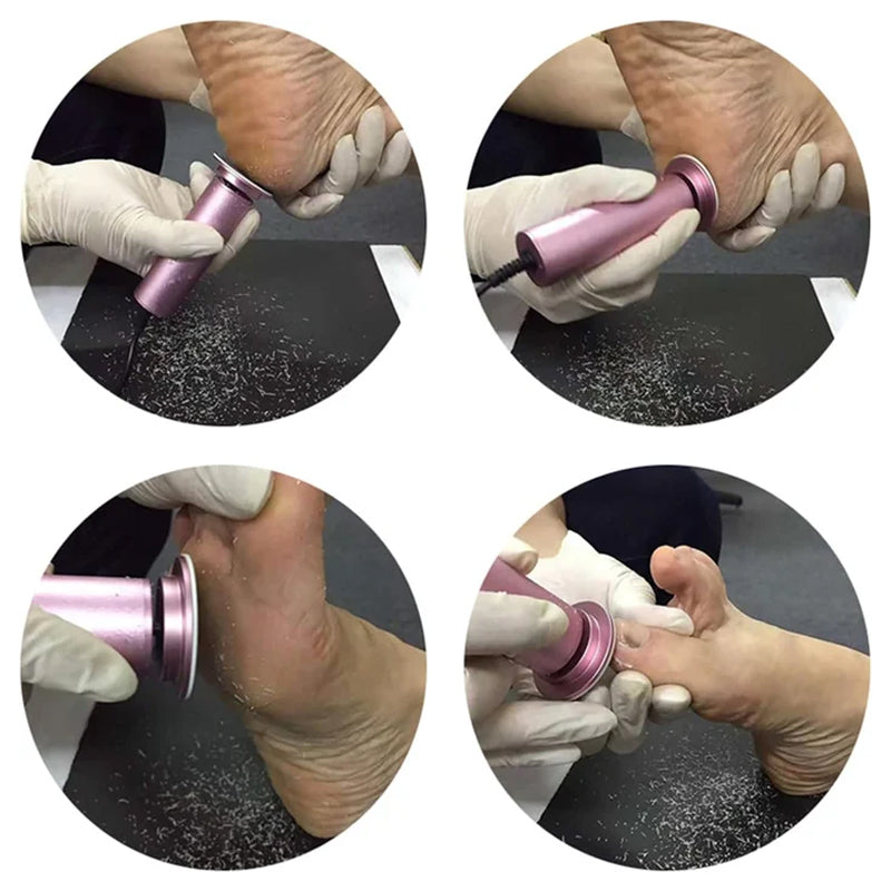 SilkyStep Pedicare™ | Voor Gladde en Gezonde Voeten