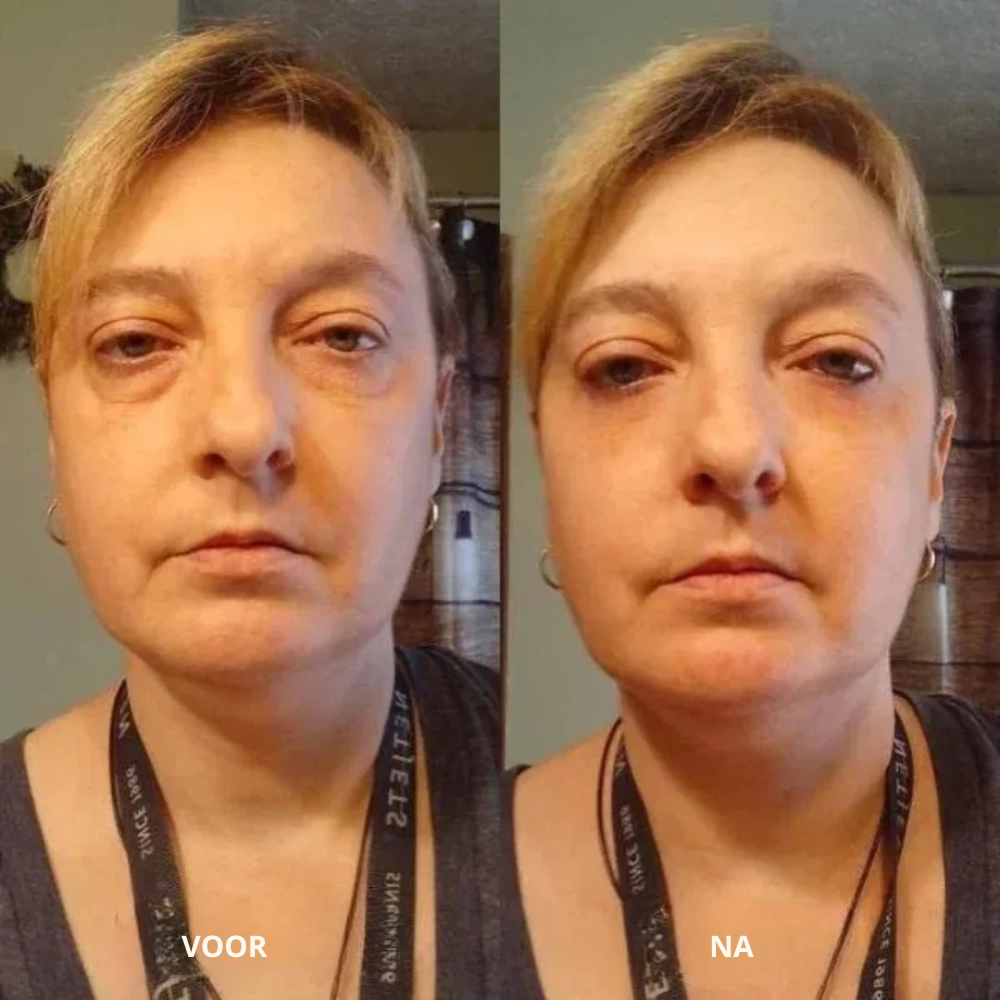 Collageen Oogpads