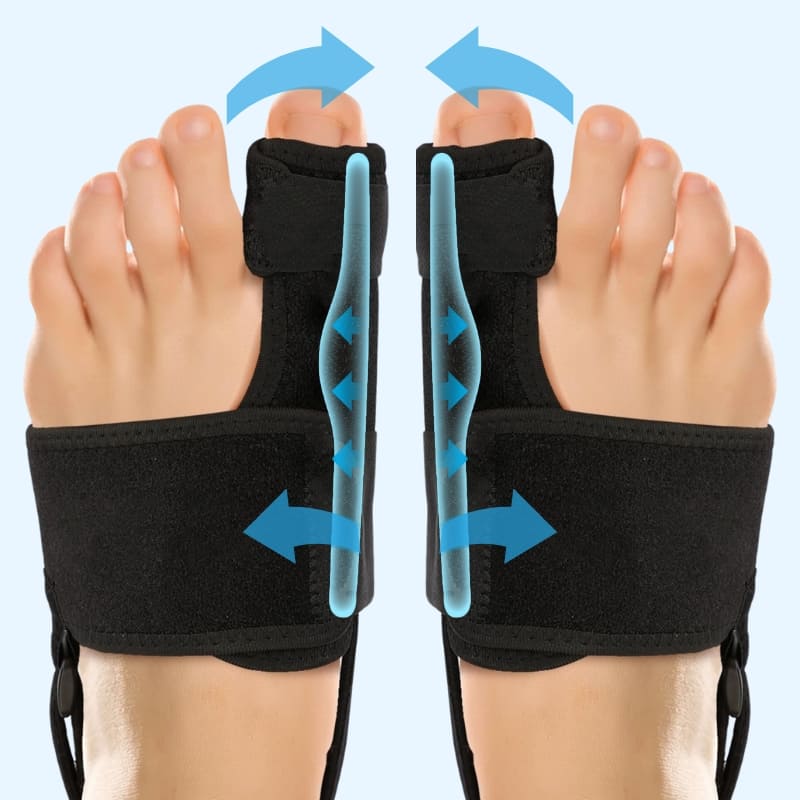 Valgus Brace | Teencorrector bij scheefstand (Hallux Valgus)