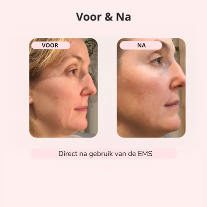 EMS LIFT – Strakkere Kaaklijn in 5 Min