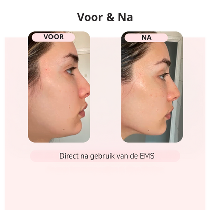 EMS LIFT – Strakkere Kaaklijn in 5 Min