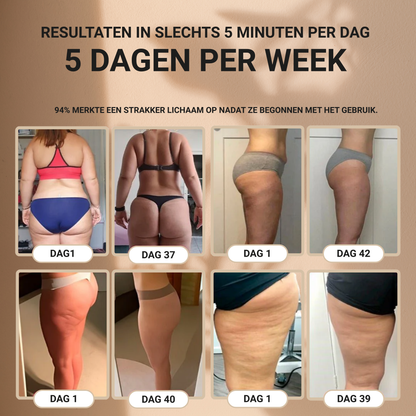 Lorena® – Anti-Cellulite Massager voor Gladde Huid