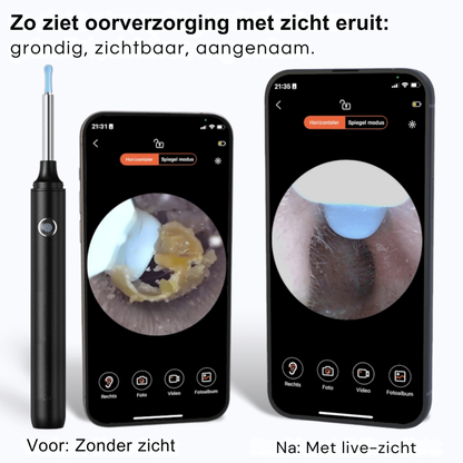 EarView Pro