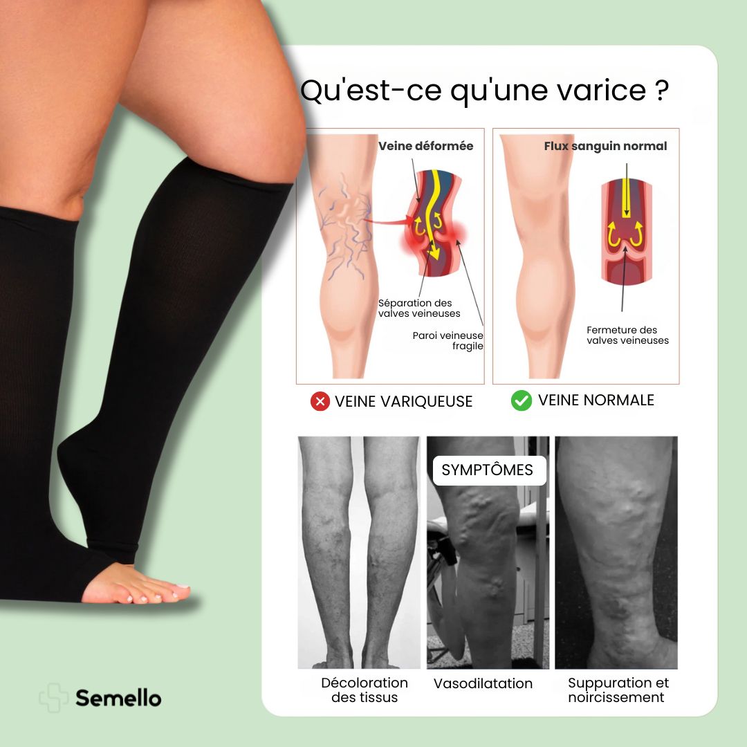 Chaussettes de contention respirante orteils libres (20-30 mmHg)